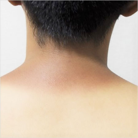塗っても効果なし 日焼け止めの スキマリスク は皮膚科医直伝の対策法で解消 アサジョ